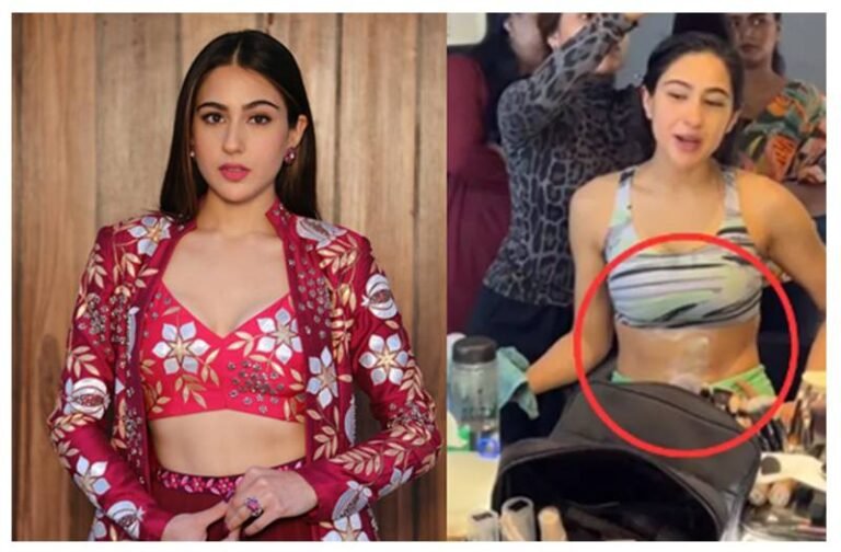 Sara Ali Khan के साथ हुआ बड़ा हादसा, एक्ट्रेस का जला पेट, वीडियो शेयर कर दिखाई हालत