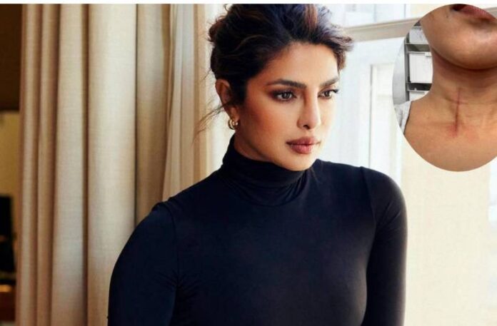 Priyanka Chopra: