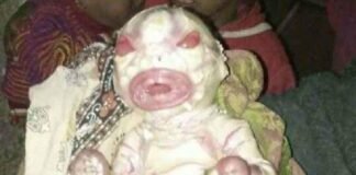 ना कान, ना नाक महिला ने दिया अजीबोगरीब बच्चे को जन्म, देखकर डॉक्टर भी हुए हैरान, लोग बोले- ‘एलियन’ Bihar Viral News