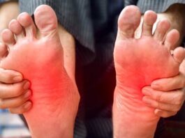 Burning Feet