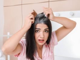 सफेद बाल