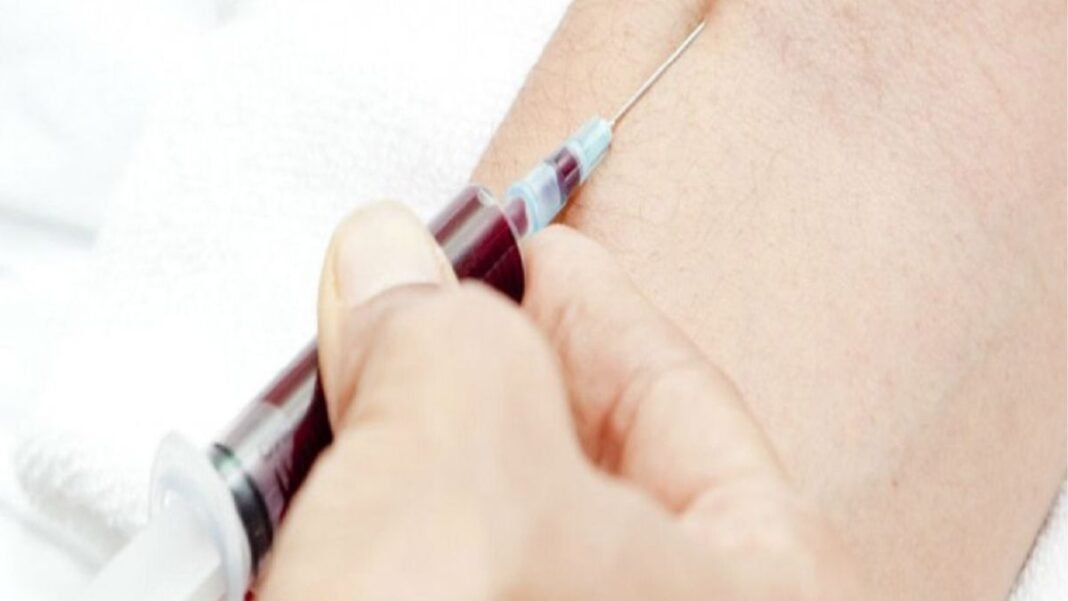 खून में छिपा है जिंदगी-मौत का राज! यह ब्लड टेस्ट बता सकता है कितने दिन जिएंगे आप