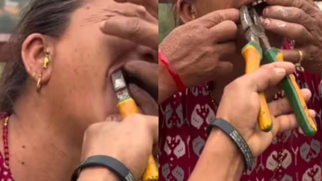 डेंटिस्ट समाज में हड़कंप! बिना एनेस्थीसिया महिला का दांत निकालता दिखा प्लास, वीडियो देख रोंगटे खड़े हो जाएंगेq एनेस्थीसिया