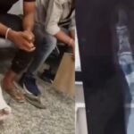 गजब का इलाज! टूटा था सिर्फ पैर का अंगूठा, डॉक्टर ने पूरे पैर को बना दिया ‘मम्मी’, वायरल वीडियो देख चकरा जाएगा सिर अंगूठा