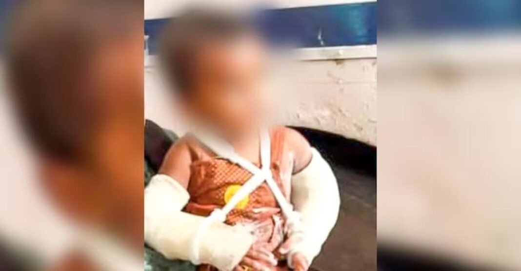 मां ही निकली जल्लाद! मासूम के शरीर पर सिगरेट से जलाने के निशान और 51 जख्मों ने तोड़ी इंसानियत की हदें मासूम अर्शिद