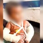 मां ही निकली जल्लाद! मासूम के शरीर पर सिगरेट से जलाने के निशान और 51 जख्मों ने तोड़ी इंसानियत की हदें मासूम अर्शिद