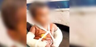 मां ही निकली जल्लाद! मासूम के शरीर पर सिगरेट से जलाने के निशान और 51 जख्मों ने तोड़ी इंसानियत की हदें मासूम अर्शिद
