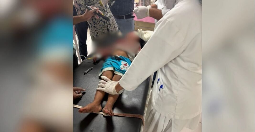 घर के बाहर खेल रहा था 3 साल का मासूम, अचानक आवारा कुत्ते ने कर दिया ऐसा हमला चेहरे पर लगे 55 टांके 3 साल का मासूम